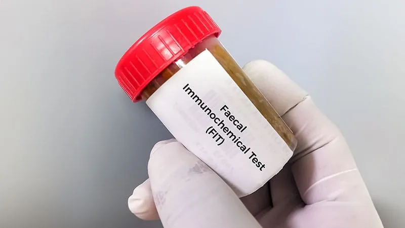 FIT screening linked to lower colorectal cancer death rates in 50-59 age group