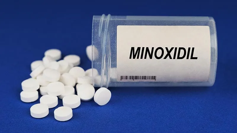 Expert Consensus Addresses Oral Minoxidil Use in Preteens