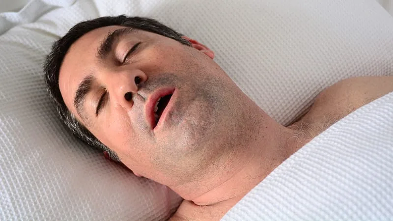 Obstructive sleep apnea linked to severe mental illness in 40% of cases