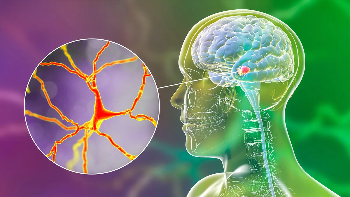 Longevity supplement shows no benefit in Parkinson's trial