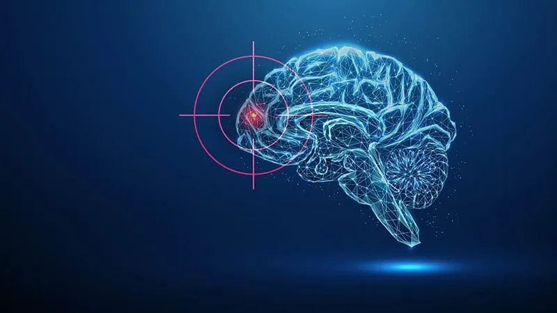 Migraine Treatment Gaps Persist Despite New Therapies
